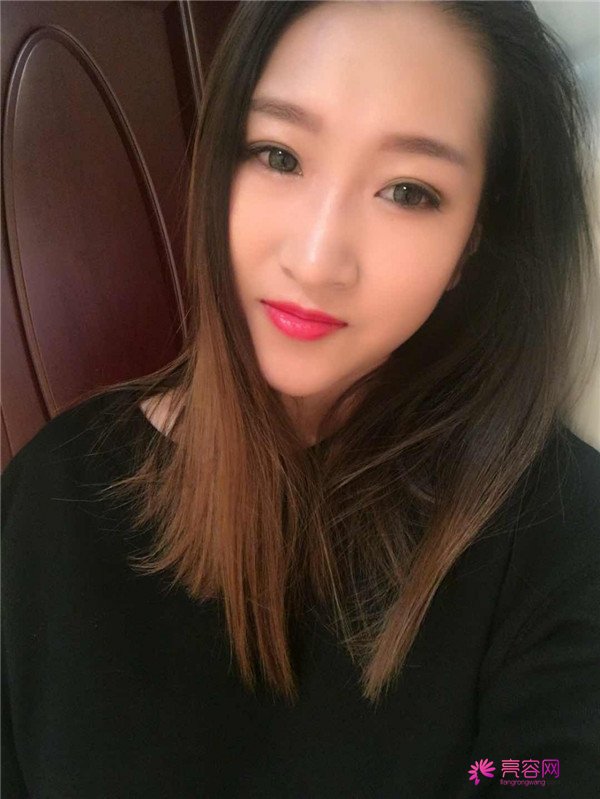 你们羡慕我的巴掌脸吗?真的只有巴掌大哦!哈哈宝宝们来看看我的案例吧,我只打了注射瘦脸哦
