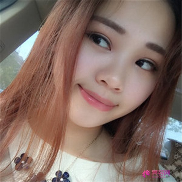 给你们分享我的全切双眼皮两个月案例啦~~~~想做双眼皮的小仙女们进来看看吧,我恢复的很好哦