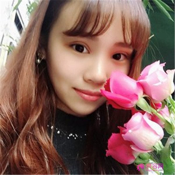 给你们分享我的全切双眼皮两个月案例啦~~~~想做双眼皮的小仙女们进来看看吧,我恢复的很好哦