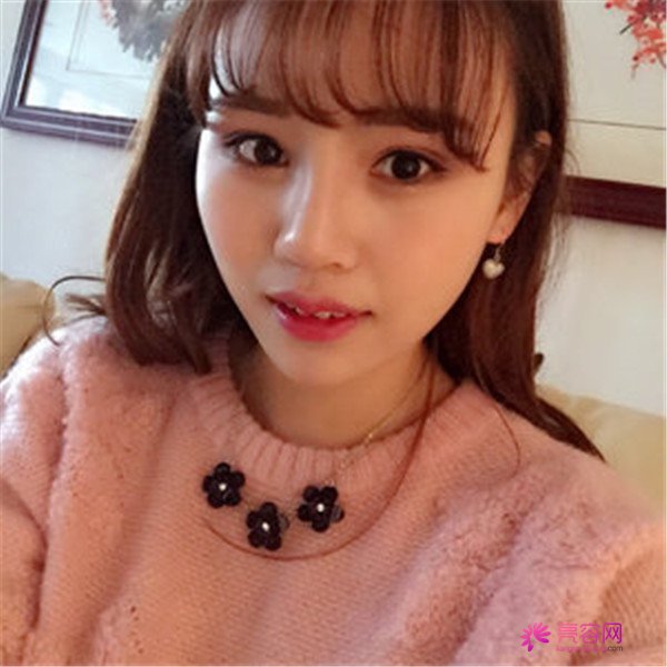 给你们分享我的全切双眼皮两个月案例啦~~~~想做双眼皮的小仙女们进来看看吧,我恢复的很好哦