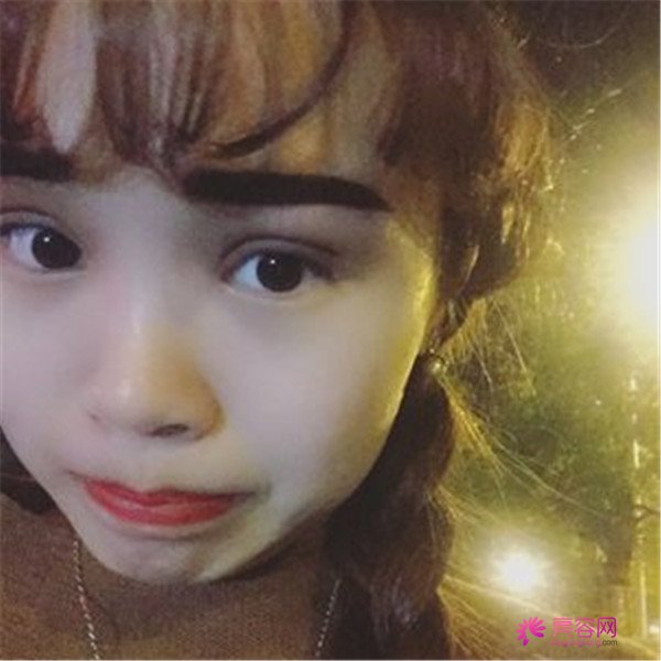 给你们分享我的全切双眼皮两个月案例啦~~~~想做双眼皮的小仙女们进来看看吧,我恢复的很好哦