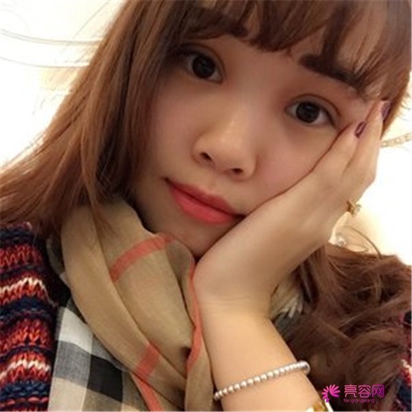 给你们分享我的全切双眼皮两个月案例啦~~~~想做双眼皮的小仙女们进来看看吧,我恢复的很好哦