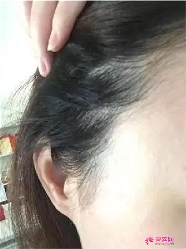 好多人都说我现在还年轻,用不着去做面部提升手术,但是就是要从年轻的时候开始保养嘛!