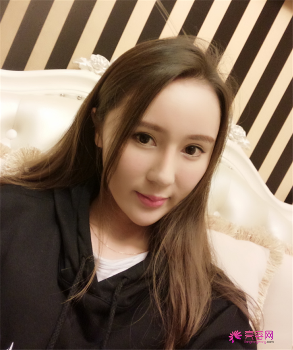 来分享我的鼻部手术案例啦~~~这个世界上没有丑女人,只有懒女人哈哈!来给个意见看看我做的怎么样?