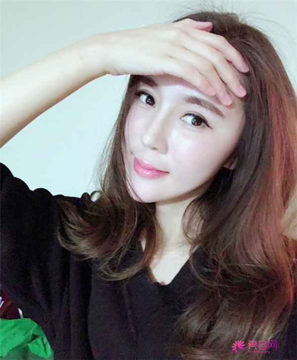 来分享我的鼻部手术案例啦~~~这个世界上没有丑女人,只有懒女人哈哈!来给个意见看看我做的怎么样?