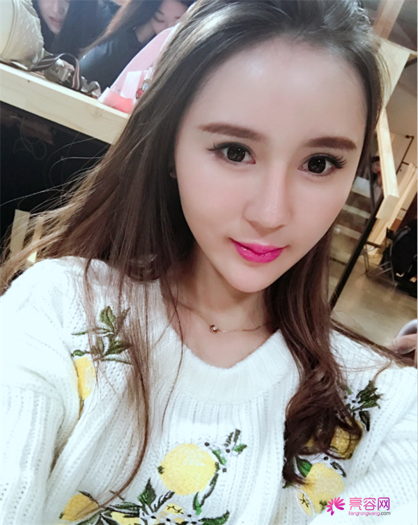 来分享我的鼻部手术案例啦~~~这个世界上没有丑女人,只有懒女人哈哈!来给个意见看看我做的怎么样?