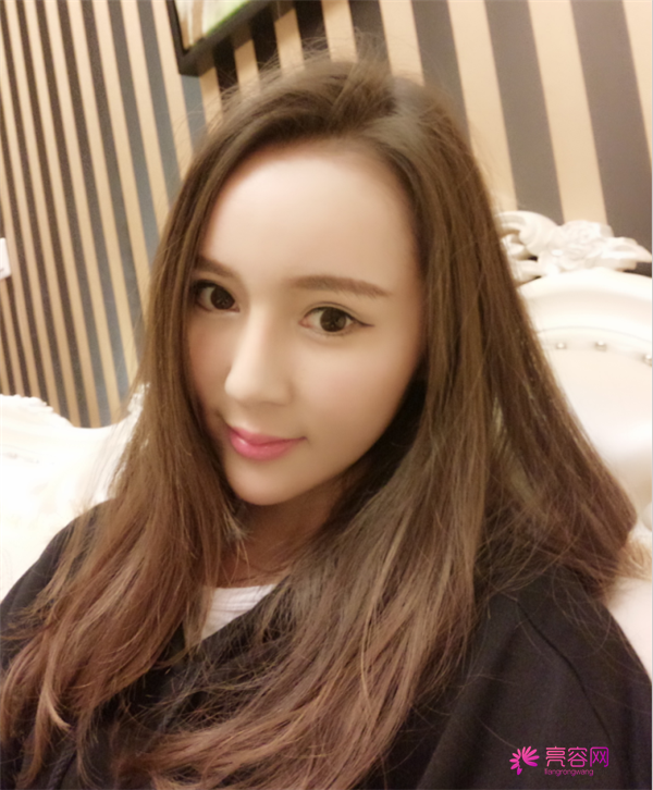 来分享我的鼻部手术案例啦~~~这个世界上没有丑女人,只有懒女人哈哈!来给个意见看看我做的怎么样?