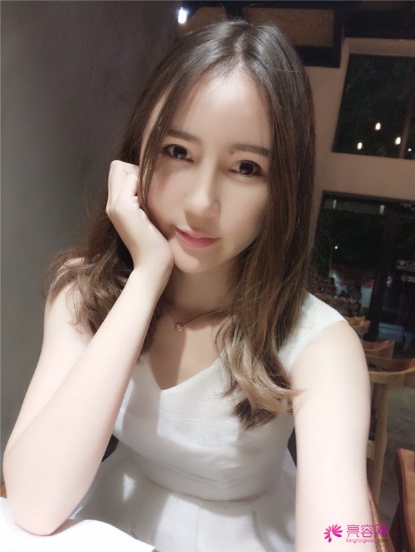 来分享我的鼻部手术案例啦~~~这个世界上没有丑女人,只有懒女人哈哈!来给个意见看看我做的怎么样?