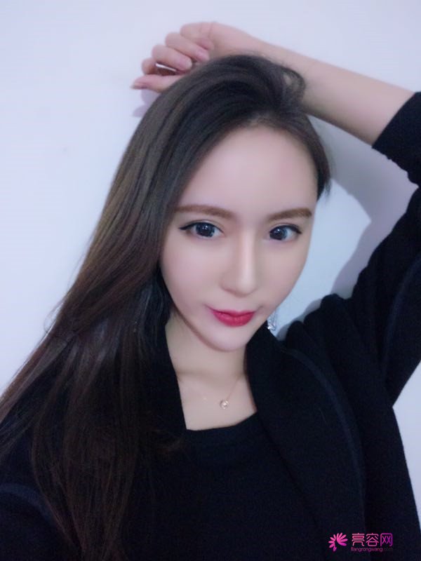 来分享我的鼻部手术案例啦~~~这个世界上没有丑女人,只有懒女人哈哈!来给个意见看看我做的怎么样?