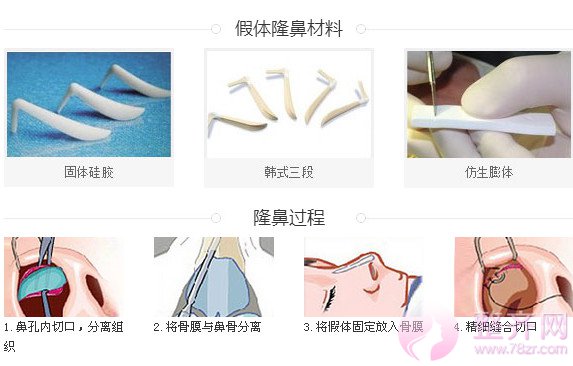 隆鼻手术后如何做才能让鼻子较好的果?