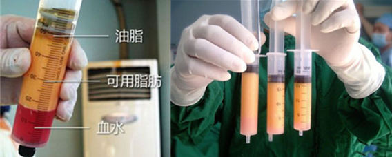 想整形~先看这些美学标准再开口!