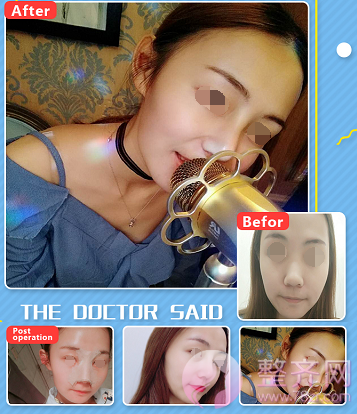 较常见的几个整形项目搭配推荐,你适合哪种?