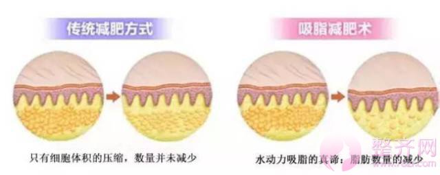 减肥!这辈子都不可能减肥的!