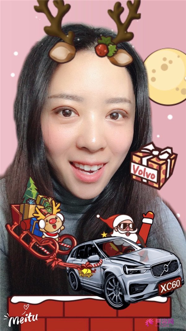 广州埋线双眼皮医院案例术后反馈分享,果怎么样?价格多少钱?一看便知!