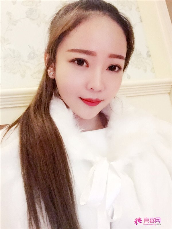 北京自体脂肪填充医院案例术后反馈分享,果怎么样?价格多少钱?一看便知!