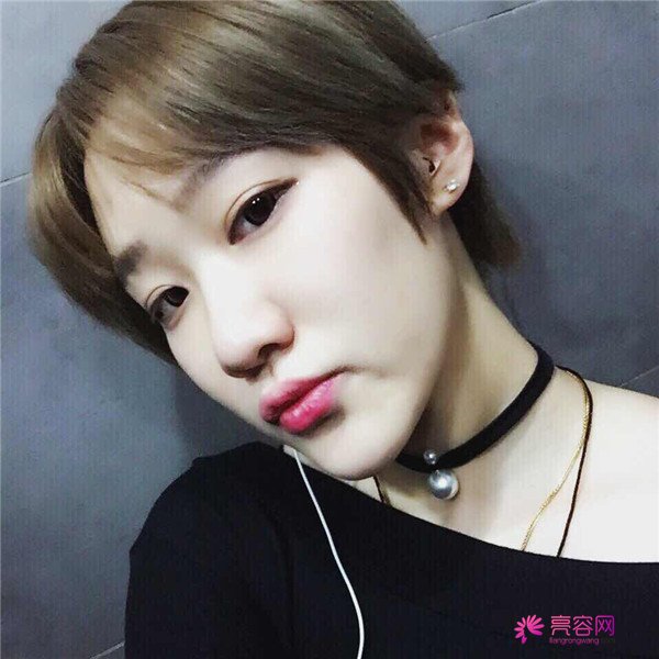 宝宝们,大家好,我来啦~我做的是眼部手术,恢复的很好哦,进来看看我的经历吧!