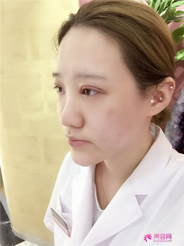 宝宝们,大家好,我来啦~我做的是眼部手术,恢复的很好哦,进来看看我的经历吧!