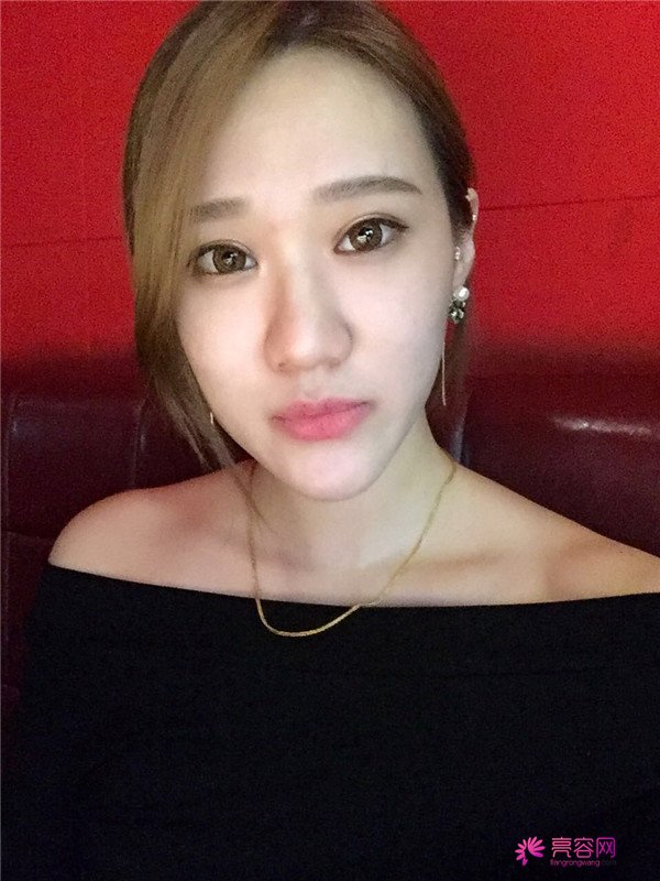 宝宝们,大家好,我来啦~我做的是眼部手术,恢复的很好哦,进来看看我的经历吧!