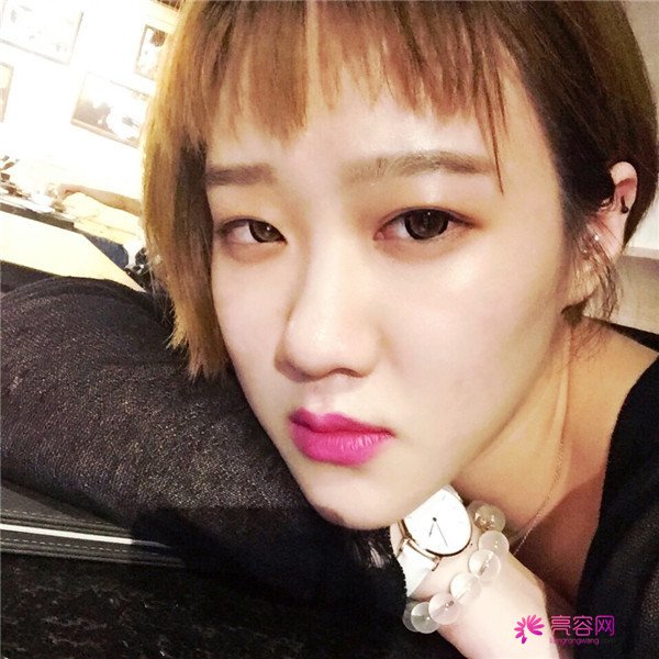 宝宝们,大家好,我来啦~我做的是眼部手术,恢复的很好哦,进来看看我的经历吧!