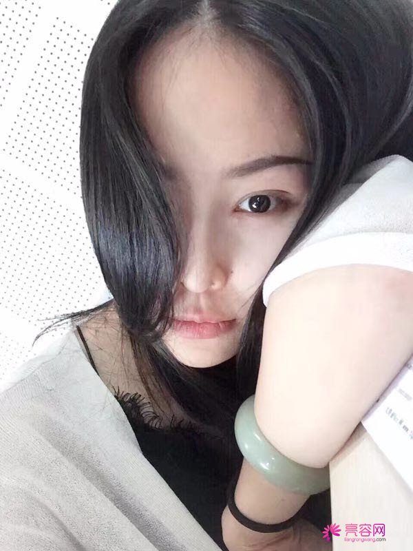 我来和大家分享我的隆鼻日记了,我自己恢复得不错,所以放心大胆的将自己的鼻子交给医院啦~