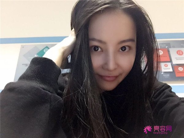 我来和大家分享我的隆鼻日记了,我自己恢复得不错,所以放心大胆的将自己的鼻子交给医院啦~