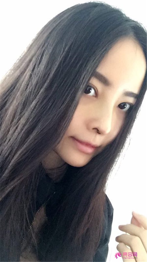 我来和大家分享我的隆鼻日记了,我自己恢复得不错,所以放心大胆的将自己的鼻子交给医院啦~