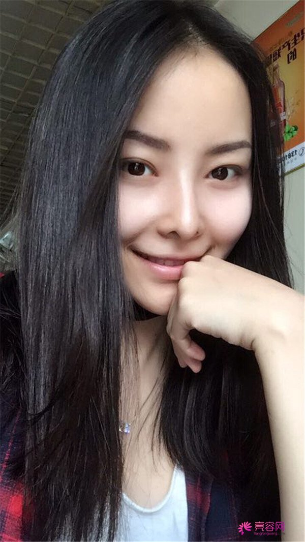 我来和大家分享我的隆鼻日记了,我自己恢复得不错,所以放心大胆的将自己的鼻子交给医院啦~