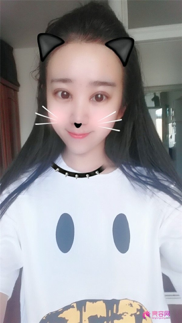 【分享案例】给宝宝们分享我的双眼皮之路啦!宝宝们我做双眼皮是打的局麻,其实局麻一点都不痛