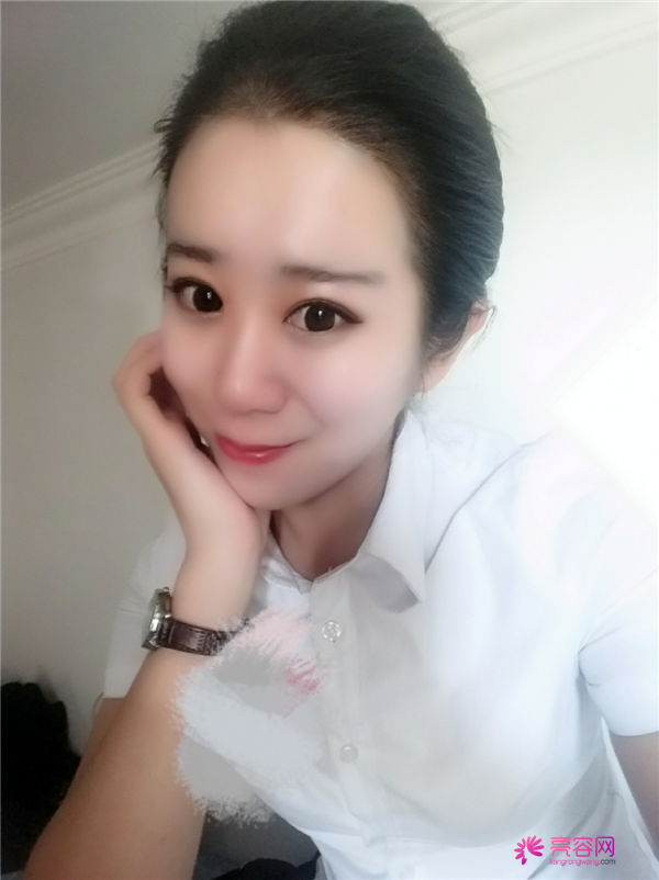 【分享案例】给宝宝们分享我的双眼皮之路啦!宝宝们我做双眼皮是打的局麻,其实局麻一点都不痛