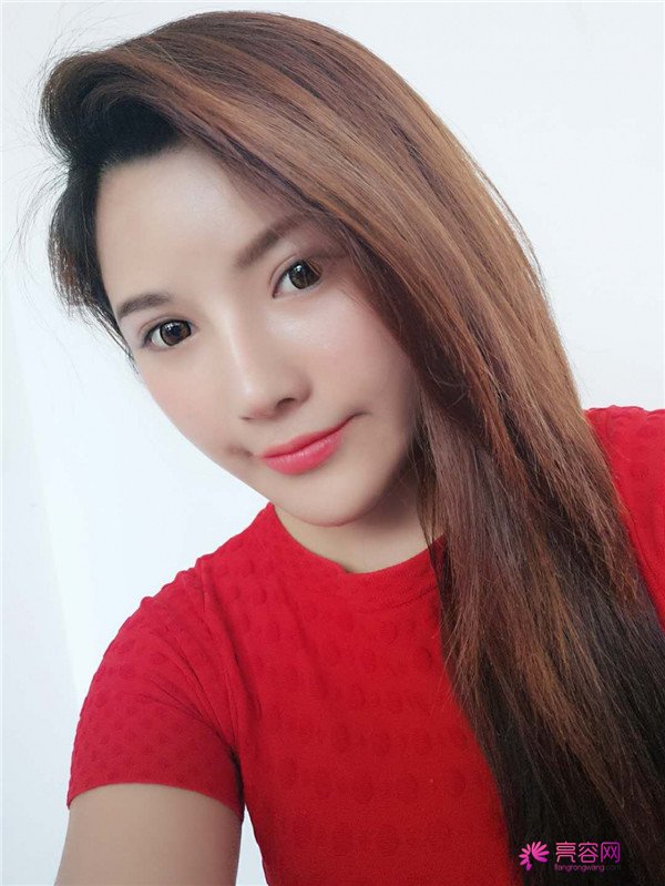 姐妹们,越是年轻越要保养!来看看我的埋线提升案例吧, 自己年轻了快10岁了