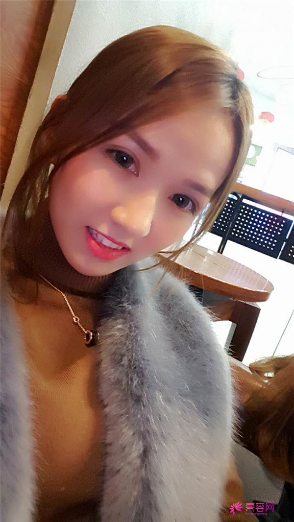 【全切+祛皮祛脂】分享我的术后恢复小妙招!宝宝们刚做完手术的前几天因为眼睛肿胀的厉害会比较丑
