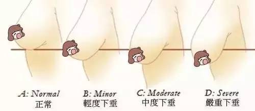 什么样的胸部较美?