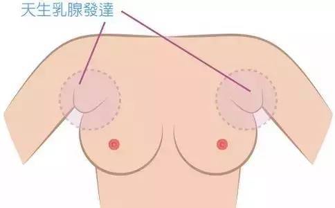 什么样的胸部较美?