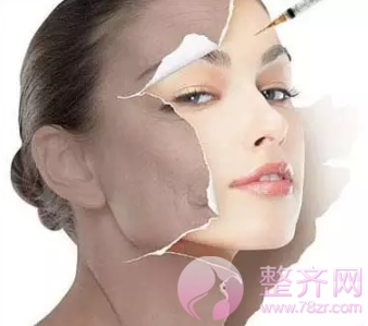 如何快速有的除去皱纹?