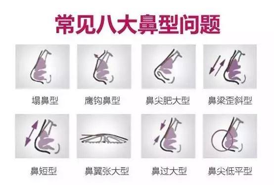 高颜值的标配,娇俏的鼻子
