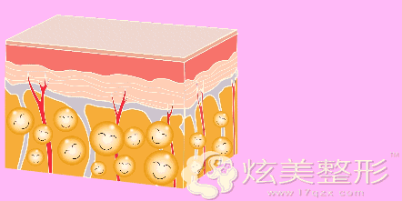吸脂到底是个什么原理呢?