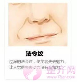 除皱是选择玻尿酸还是注射瘦脸？