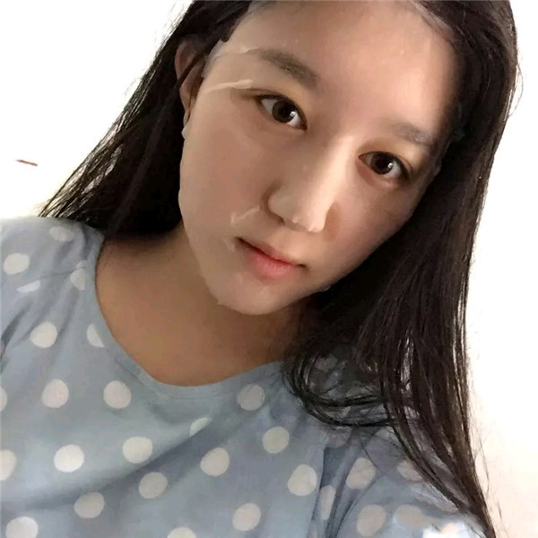 小仙女儿的鼻部手术案例分享连载(二)