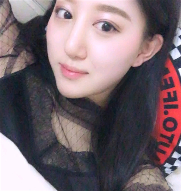 小仙女儿的鼻部手术案例分享连载(二)