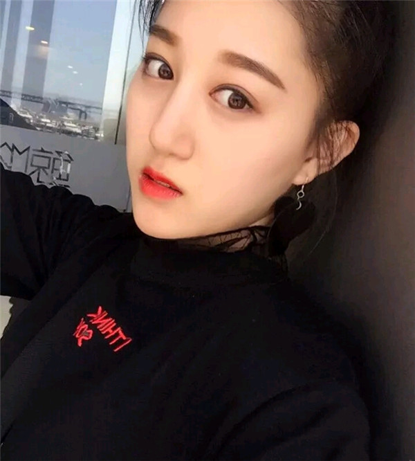 小仙女儿的鼻部手术案例分享连载(三)