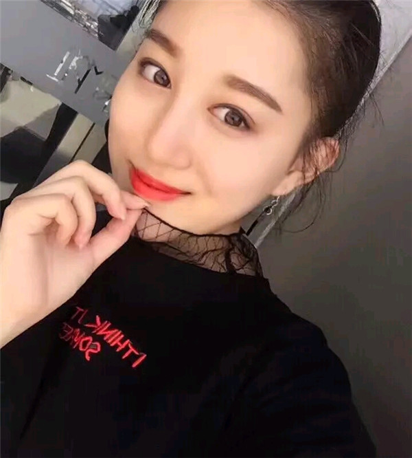 小仙女儿的鼻部手术案例分享连载(三)