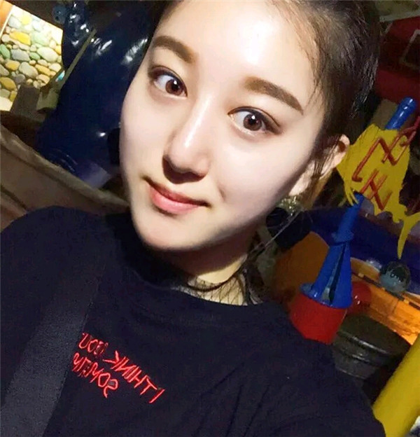 小仙女儿的鼻部手术案例分享连载(三)