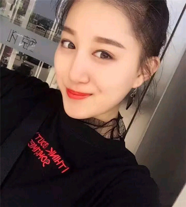 小仙女儿的鼻部手术案例分享连载(三)