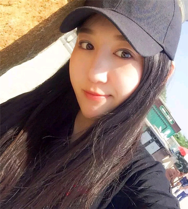 小仙女儿的鼻部手术案例分享连载(三)