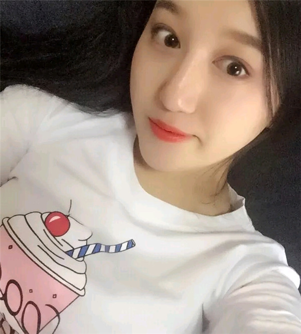 小仙女儿的鼻部手术案例分享连载(三)