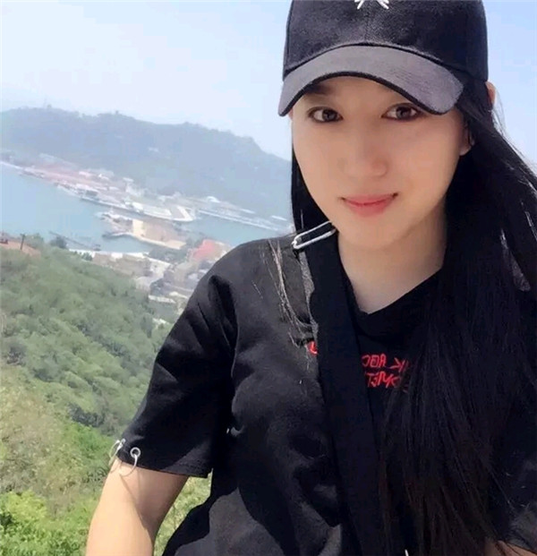 小仙女儿的鼻部手术案例分享连载(三)