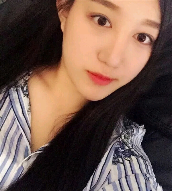 小仙女儿的鼻部手术案例分享连载(三)
