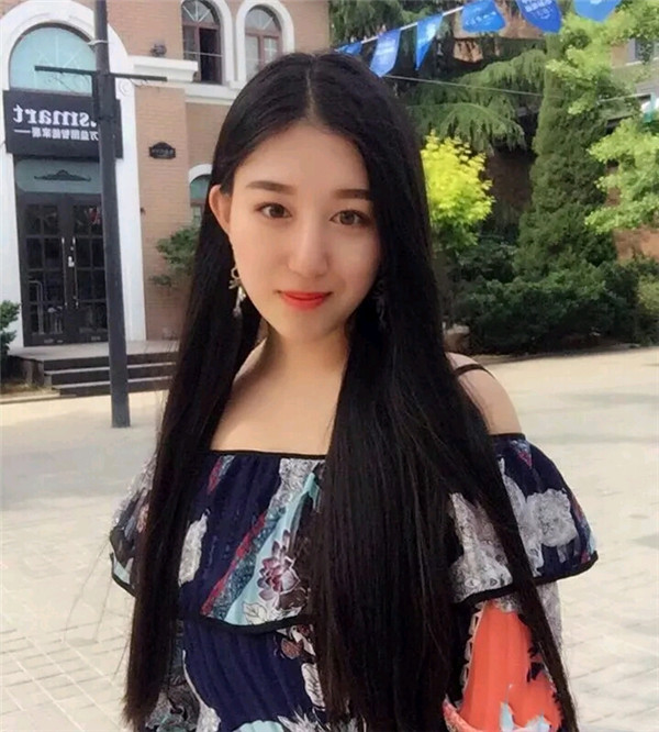 小仙女儿的鼻部手术案例分享连载(三)