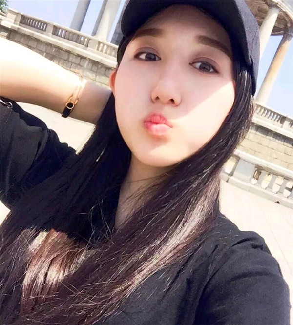 小仙女儿的鼻部手术案例分享连载(三)