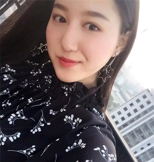 小仙女儿的鼻部手术案例分享连载(三)